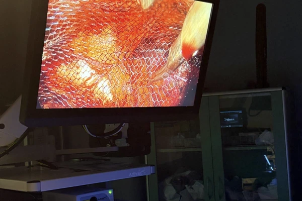 Pierwsze szkolenie Akademii Herniologicznej w Milickim Centrum Medycznym